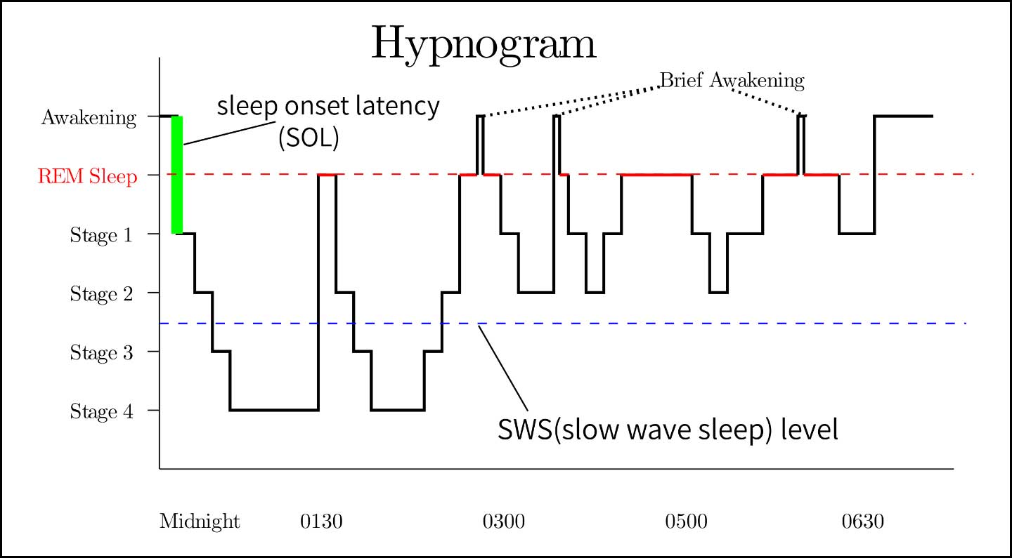 Hypnogram of a typical sleep pattern